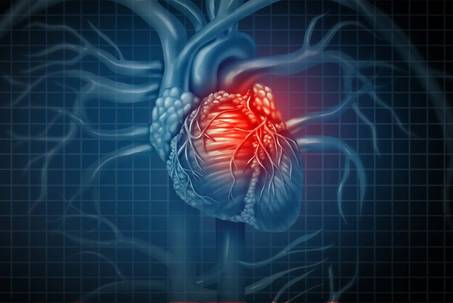 The Truth About Heart Attacks