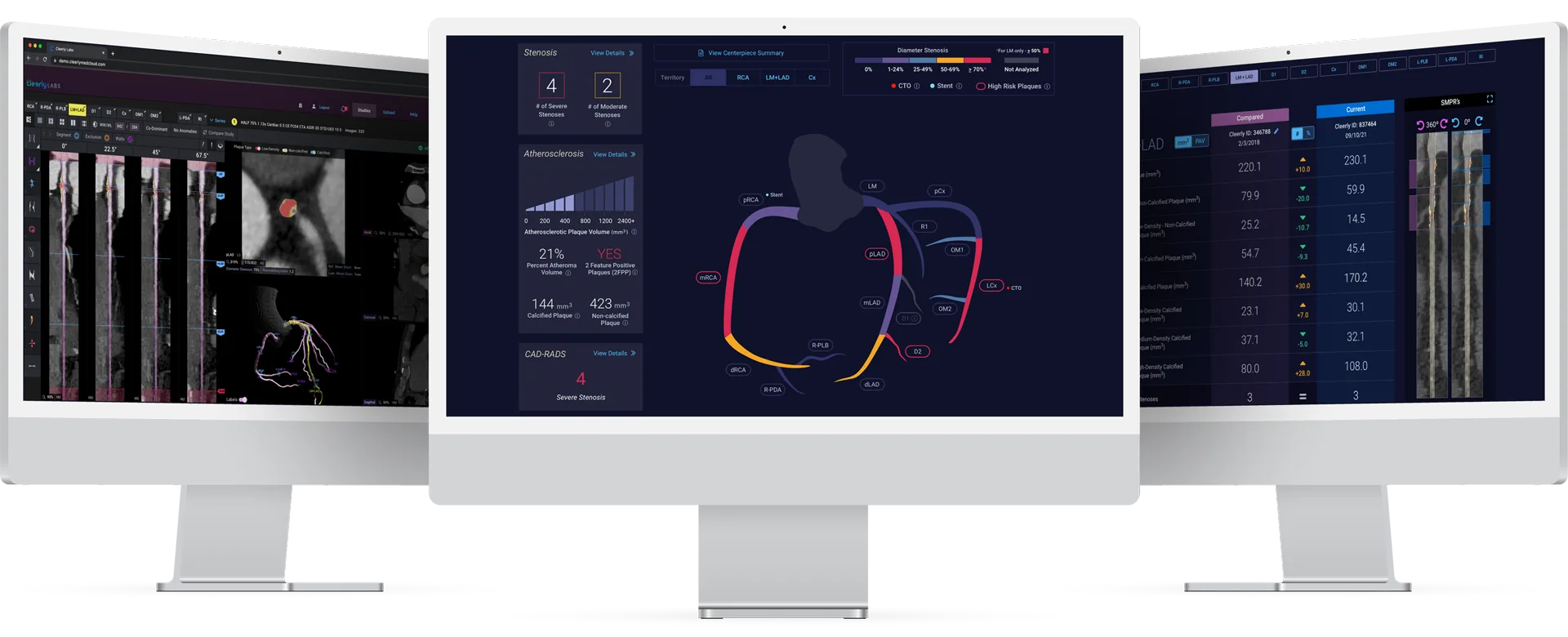 Cleerly Labs product suite